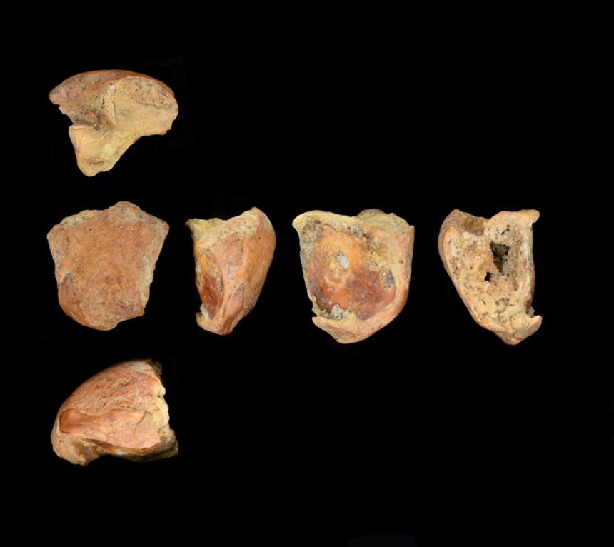 One of the Neanderthal's teeth, pictured here from different angles, was split lengthways, likely from blunt force trauma to the face.