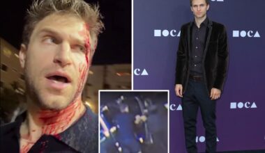 ‘Pretty Little Liars’ star blasts Gavin Newsom, Karen Bass after robbery
