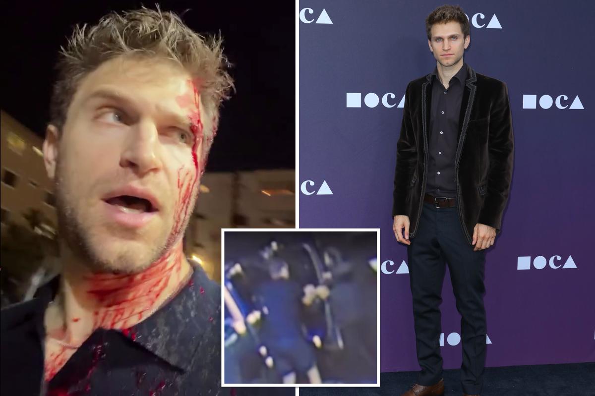 ‘Pretty Little Liars’ star blasts Gavin Newsom, Karen Bass after robbery