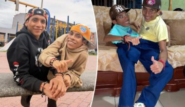 Conjoined twin influencers José Luis and José Armando Cevallos dead at 27