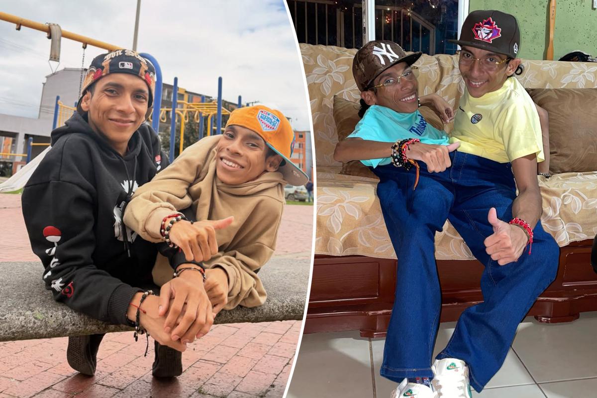 Conjoined twin influencers José Luis and José Armando Cevallos dead at 27