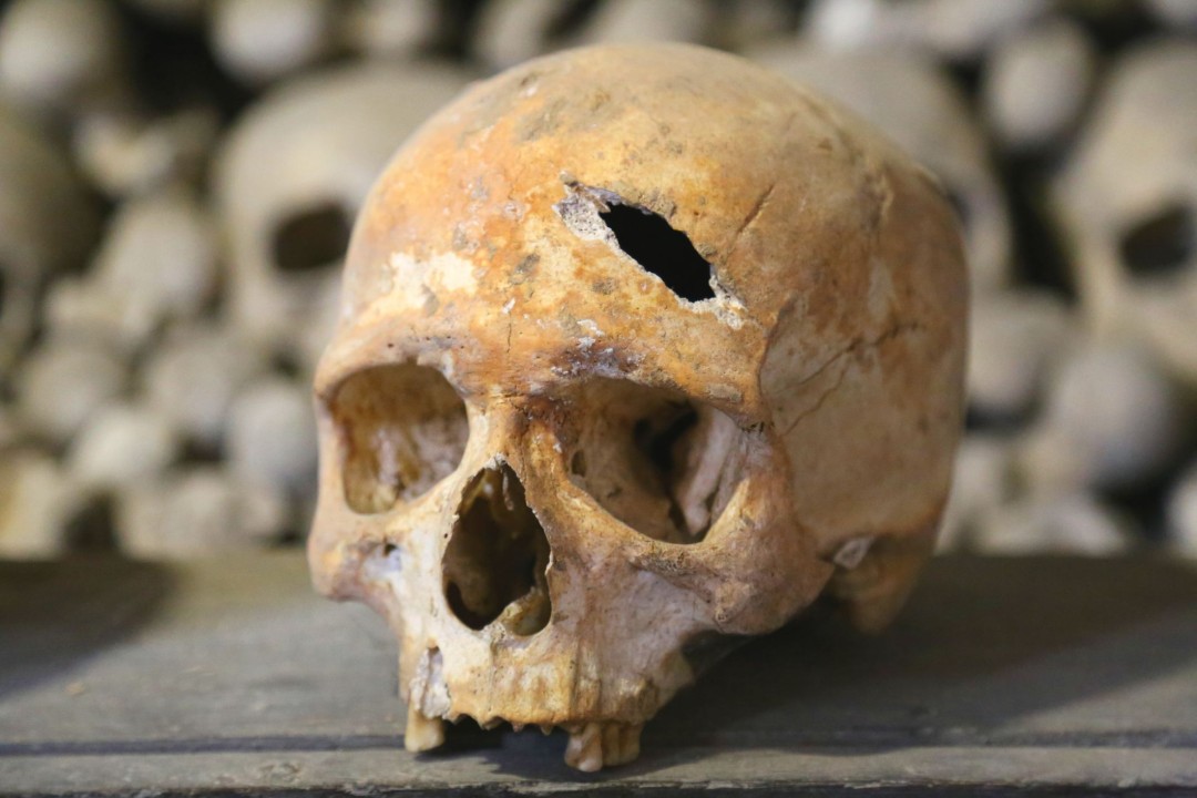 Ancient Skull Fractures Hint at Human Sacrifice in Egypt