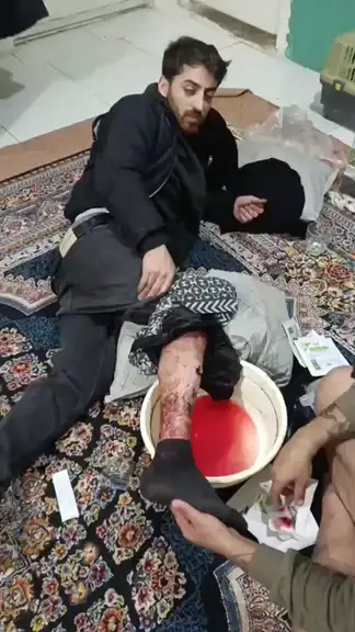 A screengrab of footage showing Hamid Kouhsari receiving makeshift treatment for a gunshot wound to his right leg while in hiding after the January 8 protests in Gorgan.