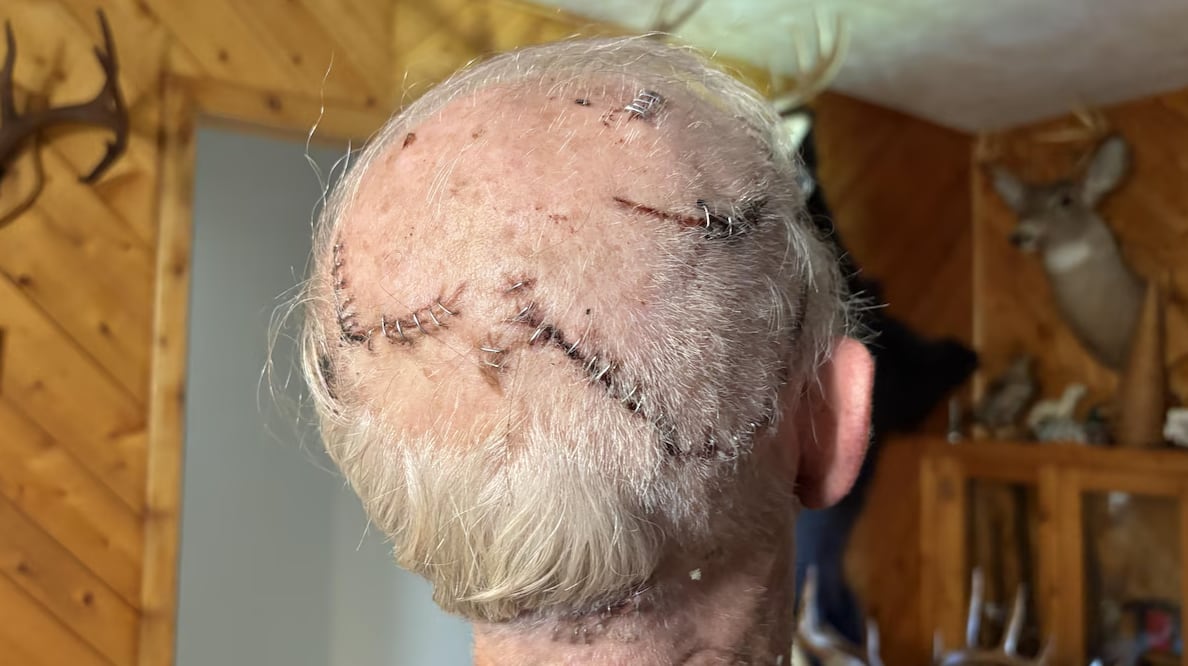 The back of a man's head