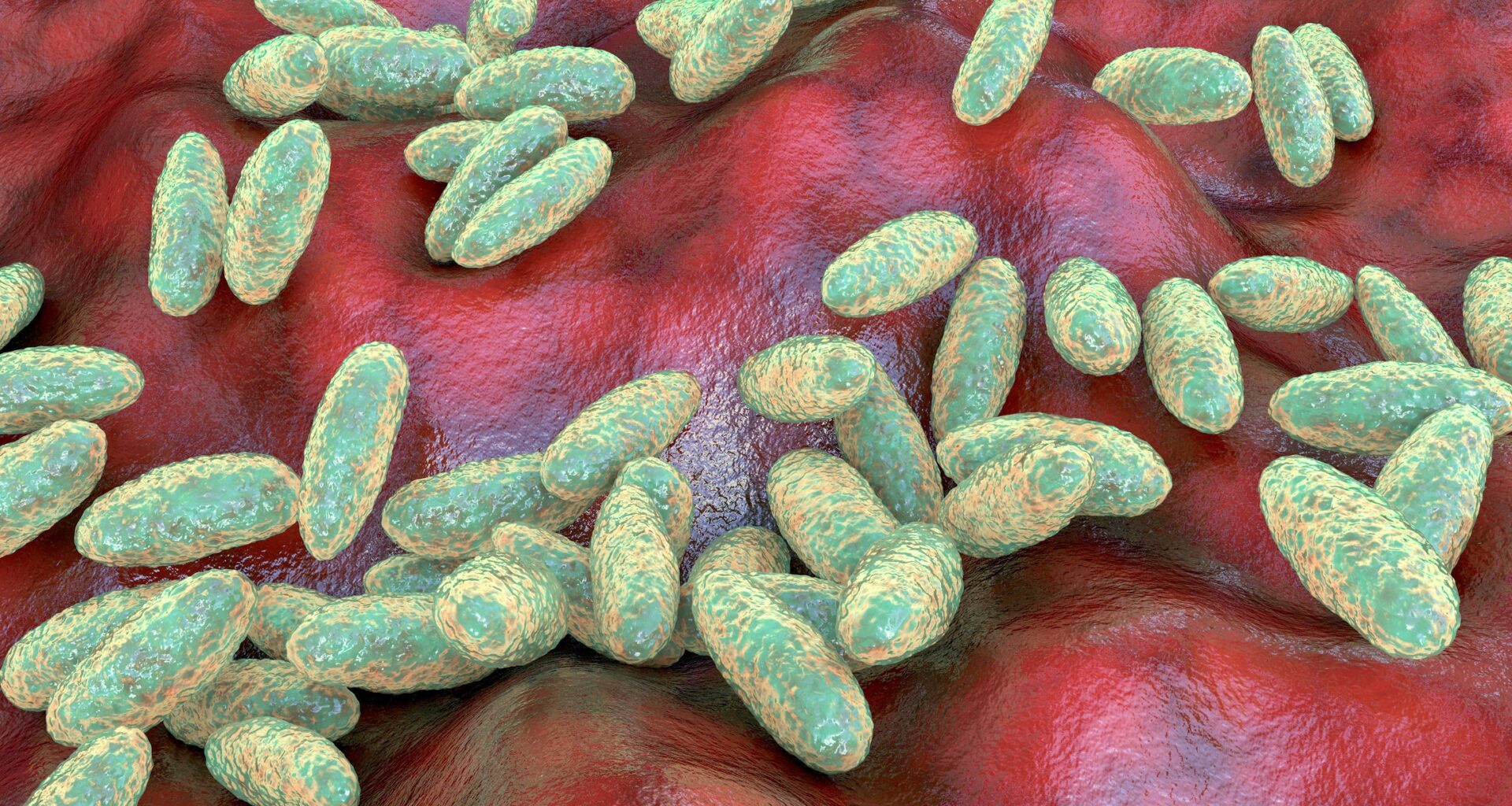 US presses Russia for answers after suspected fatal plague case surfaces