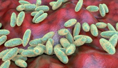 US presses Russia for answers after suspected fatal plague case surfaces