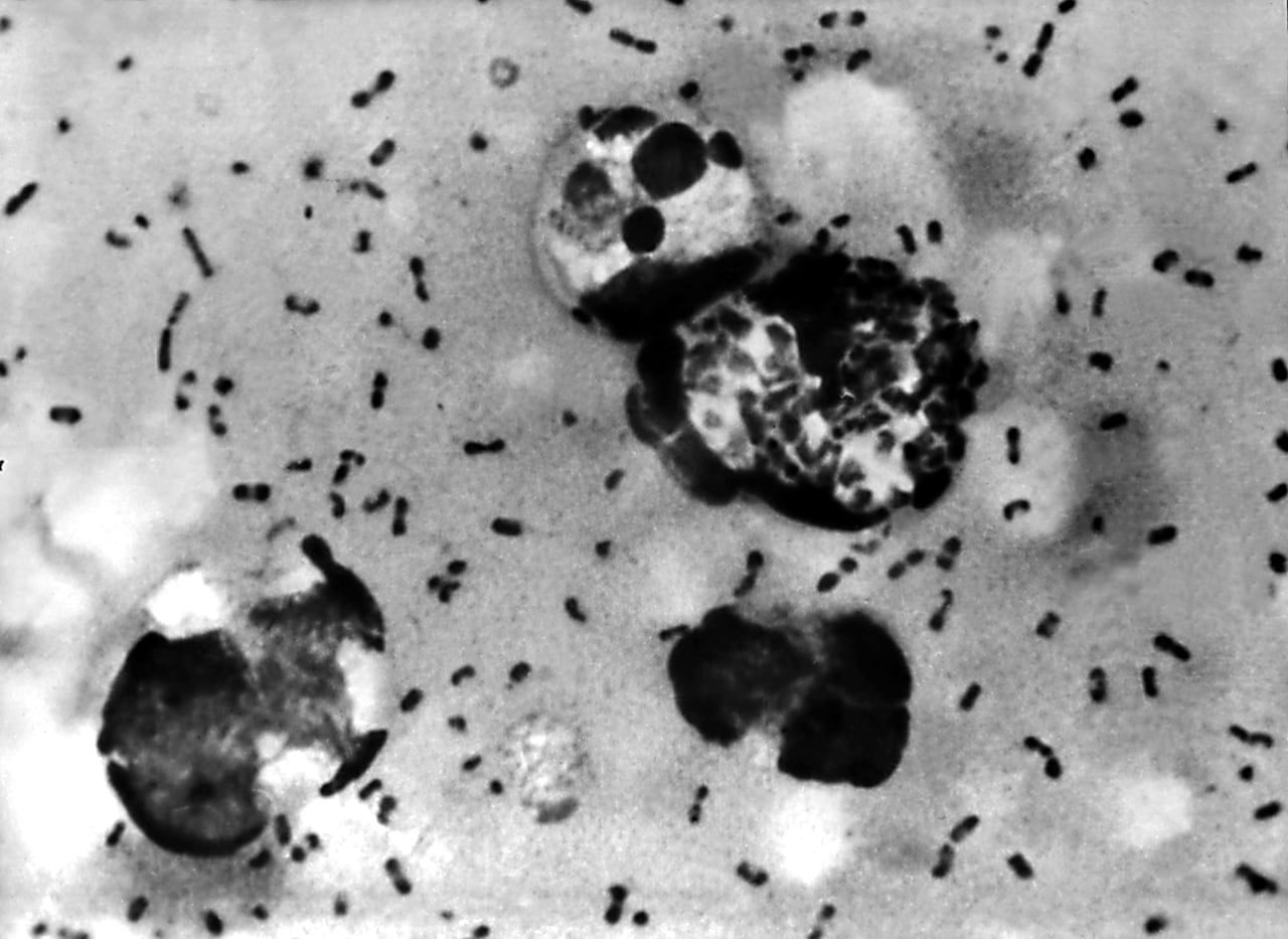 A black and white image showing a microscopic view of bacteria.