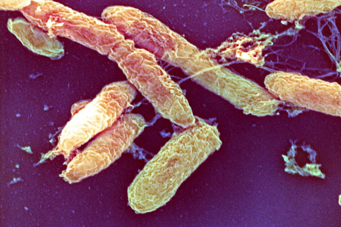 The bacteria that causes bubonic plague.