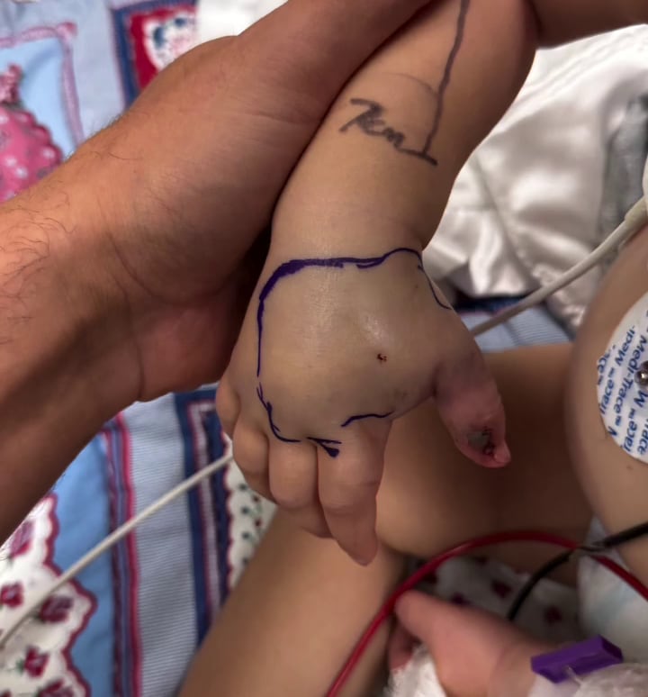 A health care worker holds a boy's arm who was being treated for a rattlesnake bite.