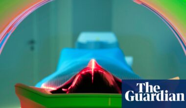 Cancer rates rising more quickly among younger people, international study finds | Cancer