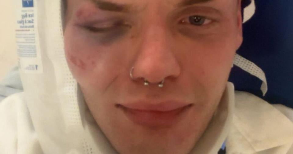 Brutal attack on gay man in downtown St. Catharines investigated as hate crime; 2 suspects now charged - Niagara This Week