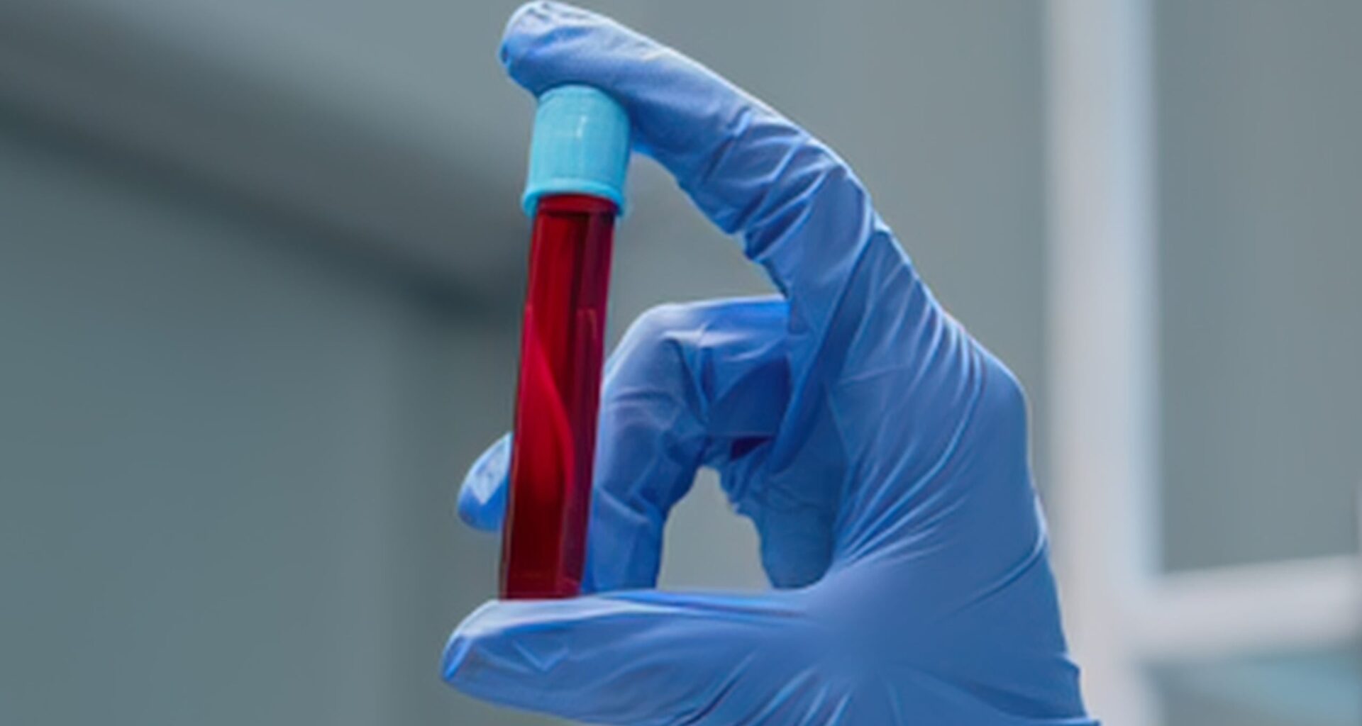 We May Have Been Wrong About Fasting Before Blood Tests, Study Reveals : ScienceAlert