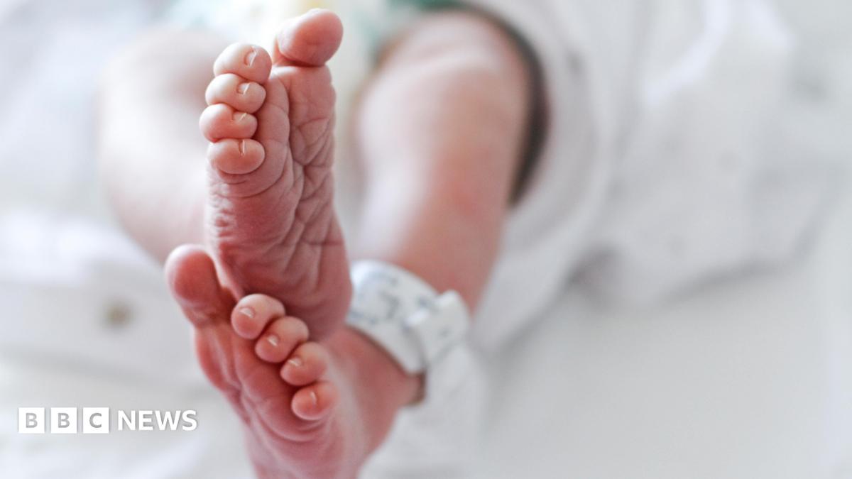 The feet of a newborn baby with a hospital tag attached to a leg.