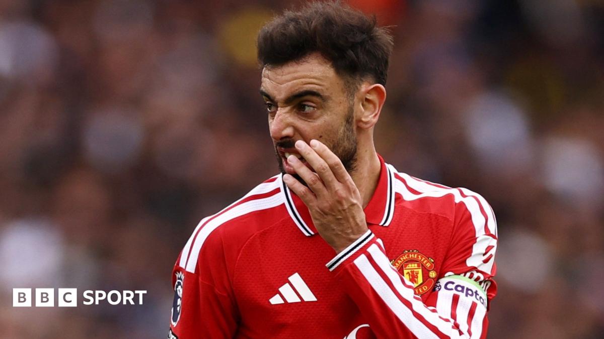 Bruno Fernandes scowls