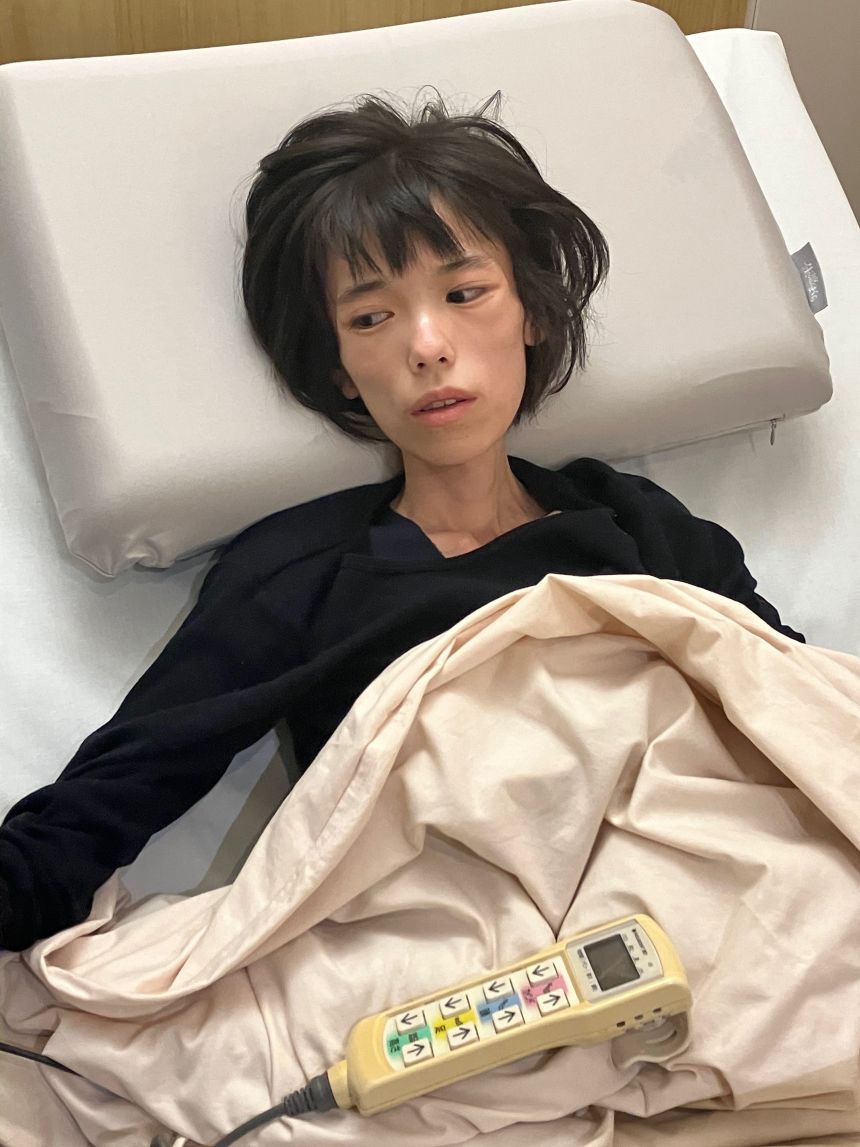 After being released from jail, Runa's weight continued to drop.