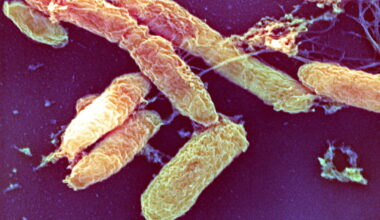 What is the pneumonic plague? : NPR