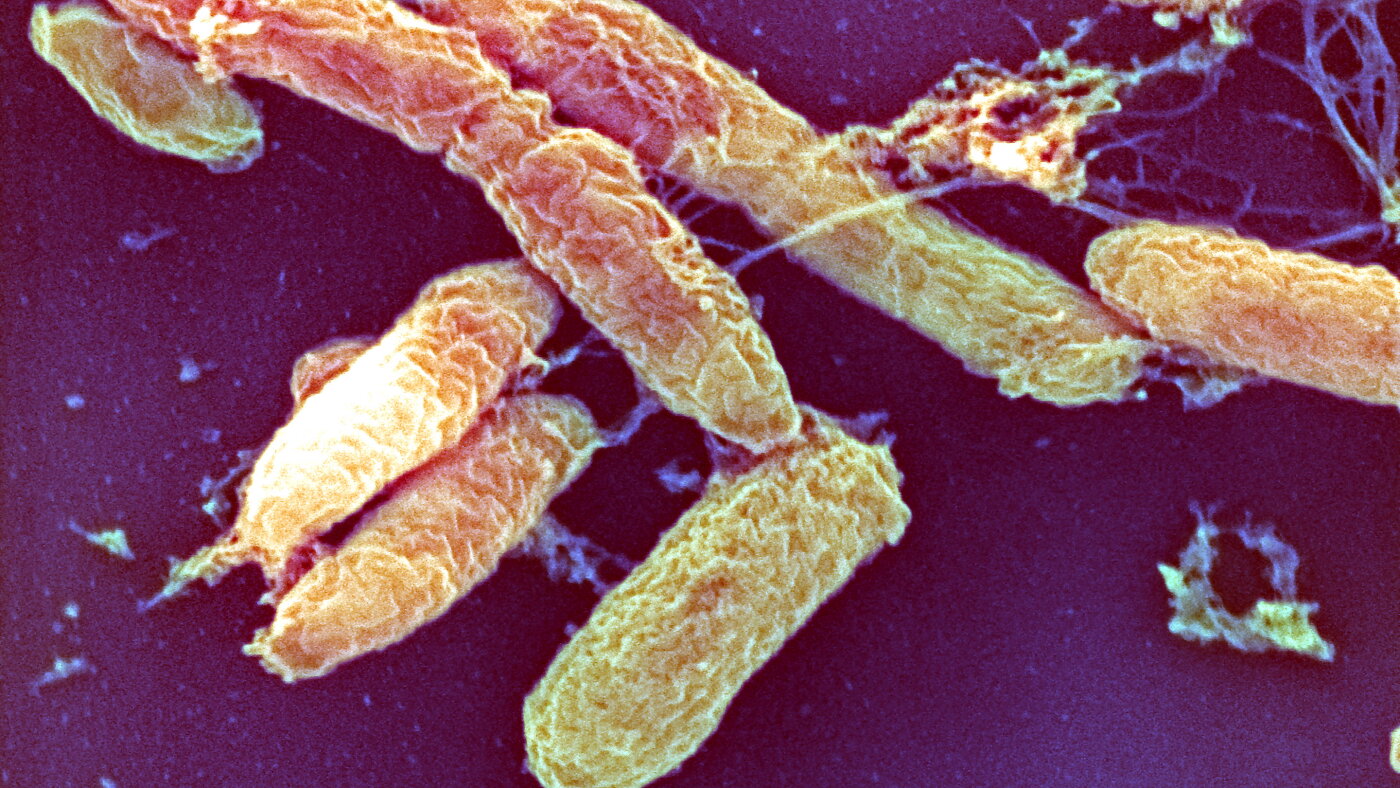 What is the pneumonic plague? : NPR